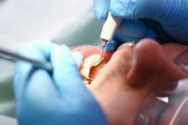 Emergency Gum Pain Relief in CO